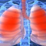 Astma nije bolest pluća: Evo kako je izliječiti na prirodan način!