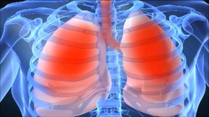 Astma nije bolest pluća: Evo kako je izliječiti na prirodan način!