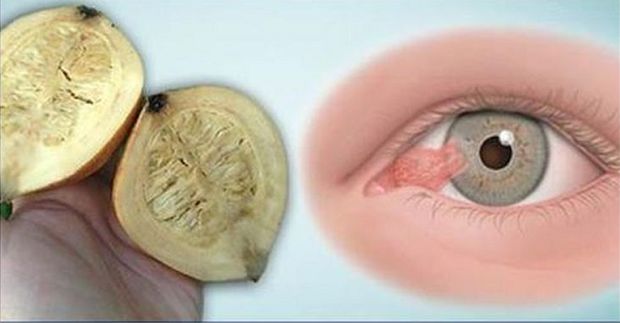 Savršen lijek za bolji vid: Uzmite prije spavanja i ujutro ćete imati obnovljeno 80% svog vida!