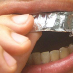 UŠTEDITE BOGATSTVO Evo šta se desi ako na jedan sat zube omotate aluminijskom folijom!