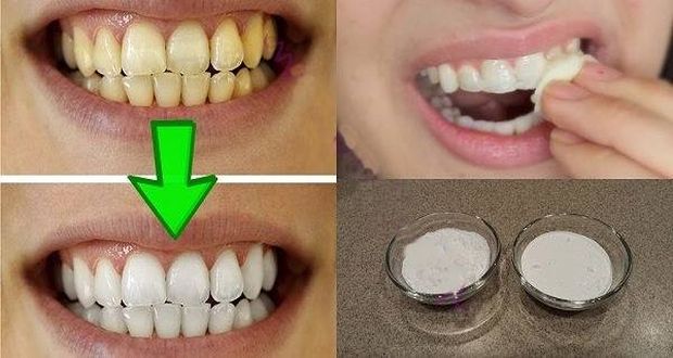 Zagarantovano izbjeljivanje zuba za manje od 2 minuta!