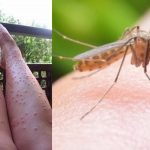 Komarci su mi UNIŠTILI LJETO: Ali kad sam naučila OVAJ TRIK – nikada me više nije ugrizao NIJEDAN
