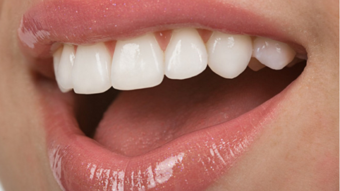 Uklonite Kamenac, Izbelite Zube I Osvežite Dah: Sve To U Samo 4 Koraka, A Sastojke Imate Kod Kuće