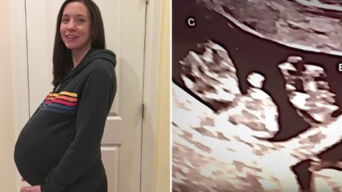 Majka je trudna sa trojkama, onda je doktor bolje pogledao ultrazvuk i PREBLIJEDIO!