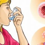 BOLEST MODERNOG DOBA! Astma nije bolest pluća: Evo kako je izliječiti na prirodan način