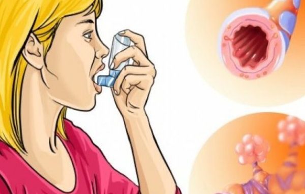 BOLEST MODERNOG DOBA! Astma nije bolest pluća: Evo kako je izliječiti na prirodan način